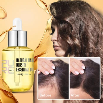 SHAY_ONLINE ™ Anti Hair Loss & Hair Growth Serum