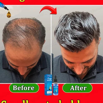 SHAY_ONLINE ™ Anti Hair Loss & Hair Growth Serum