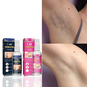 Permanent Hair Removal Spray